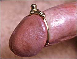 frenum ring