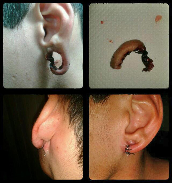 necro-ear